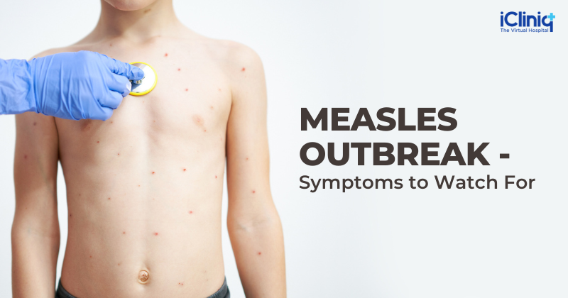 Measles Outbreak – How Does It Start?