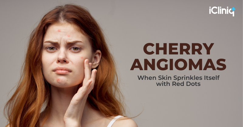 When Skin Sprinkles Itself with Red Dots