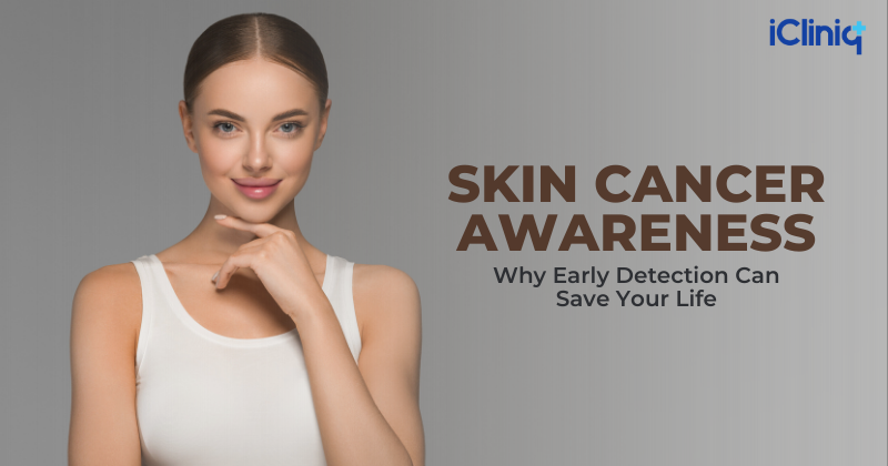 Why Early Detection Can Save Your Life